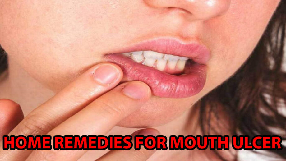 Home Remedies To Get Rid Of Mouth Ulcers