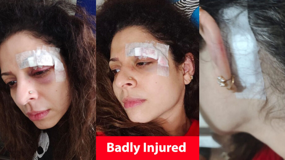 OMG: Apna Time Bhi Aayega Actress Tannaz Irani badly injured, shares pictures