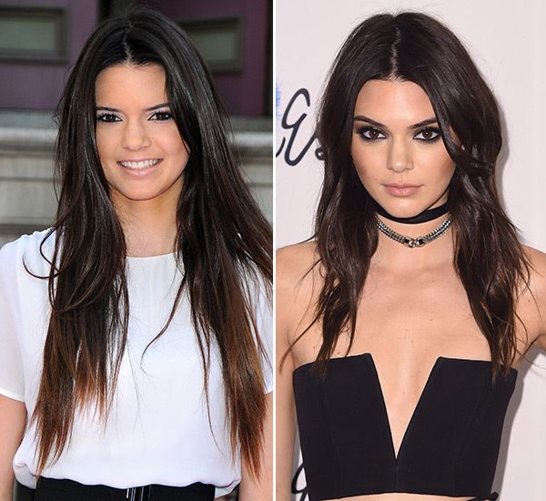 Young Kendall Jenner looks Then vs. Now Fans can’t stop melting IWMBuzz