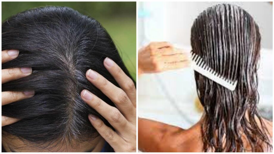 3 Homemade Masks That Prevent Premature Greying Of Hair | IWMBuzz