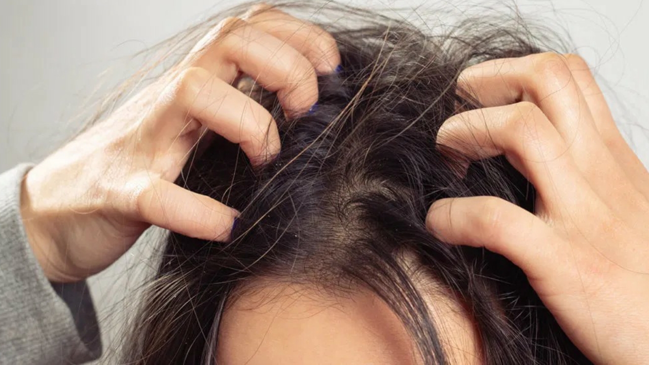 Get The Right Solutions To All Your Hair And Scalp Problems Here | IWMBuzz