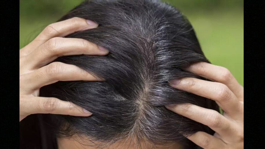 Natural Remedies To Get Rid Of White Hair Forever | IWMBuzz