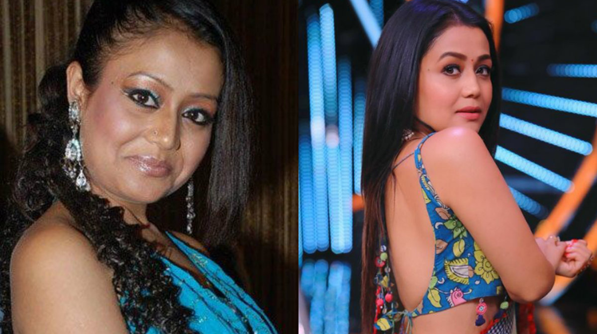 Then Vs Now: Check Out Drastic Face Transformation Of Neha Kakkar That Will Leave You Speechless, View Pics 503030