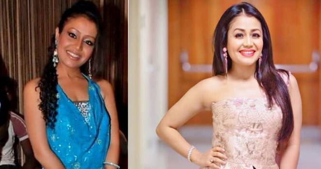 Then Vs Now: Check Out Drastic Face Transformation Of Neha Kakkar That Will Leave You Speechless, View Pics 503031