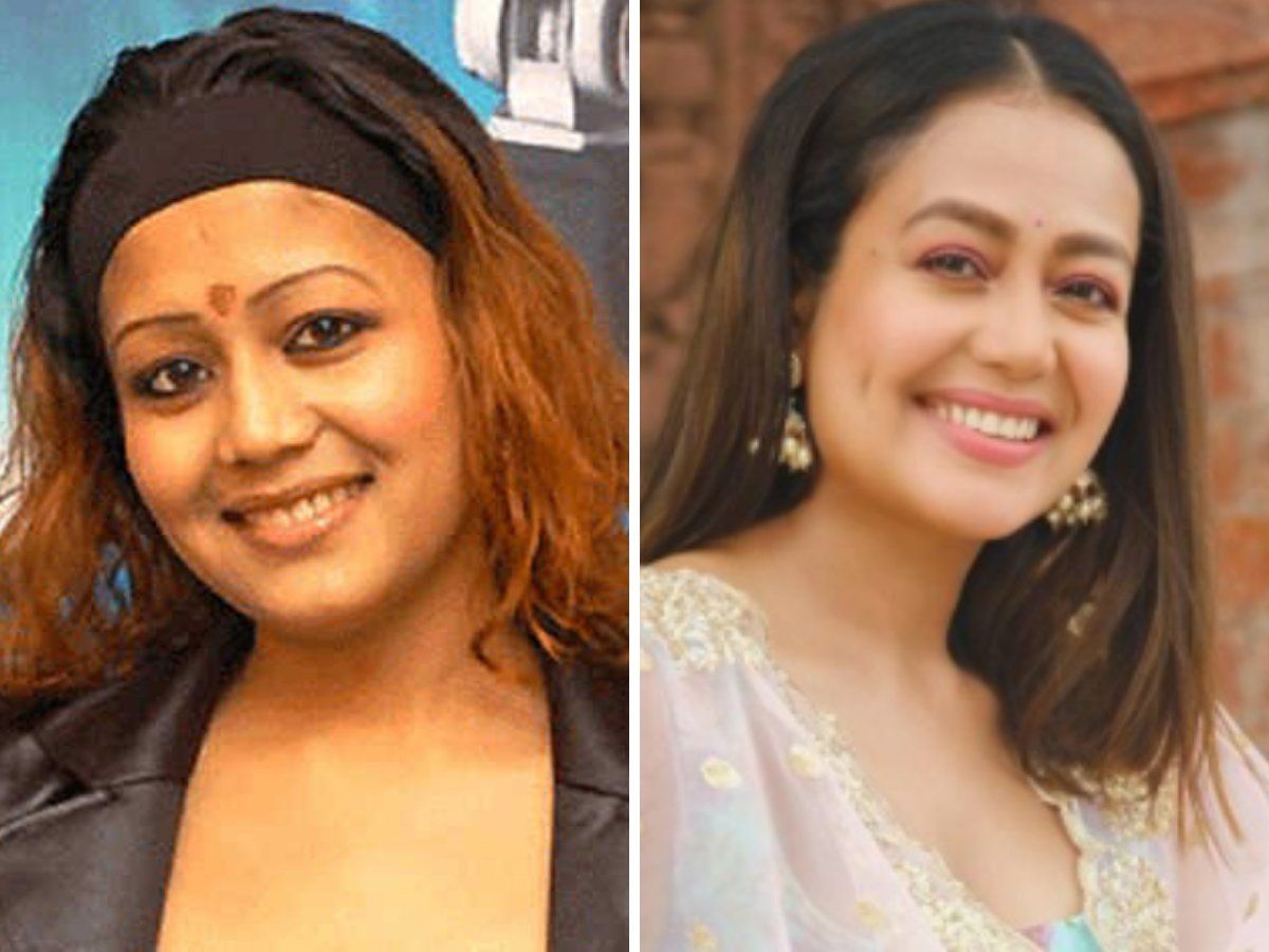 Then Vs Now: Check Out Drastic Face Transformation Of Neha Kakkar That Will Leave You Speechless, View Pics 503033