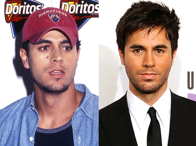 Unknown Male Celebrities Who Underwent Plastic Surgery 763215