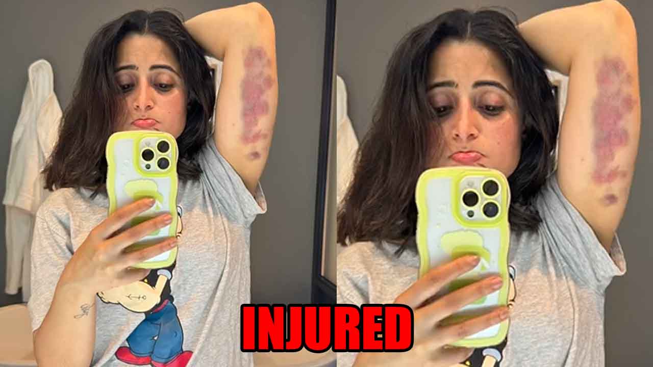 Khatron Ke Khiladi 13 contestant Aishwarya Sharma gets badly injured, shares photo of her bruises 809004