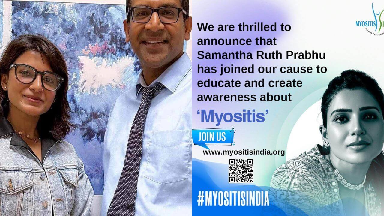 Samantha Ruth Prabhu joins ‘Myositis India’ as brand ambassador, deets inside 845866