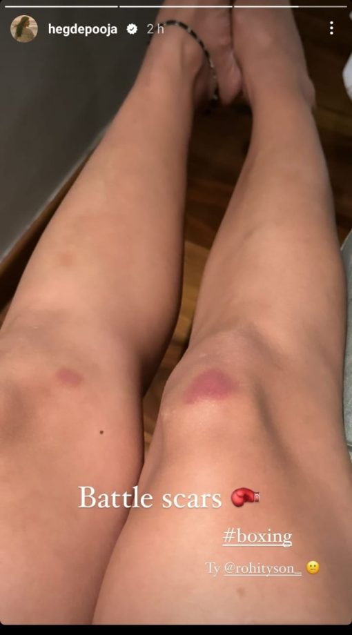 Pooja Hegde Is Bruised; Shows Her 'Battle Scars' 858179
