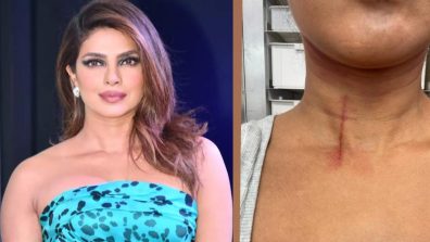 Priyanka Chopra Suffers Neck Injury While Filming ‘The Bluff,’ Checkout Photos!
