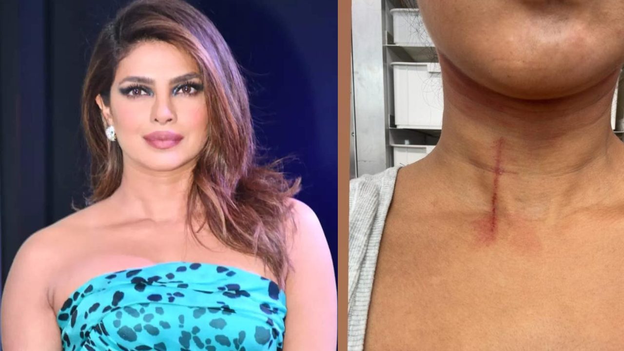 Priyanka Chopra Suffers Throat Injury While Filming 'The Bluff,' Checkout Photos! 901267