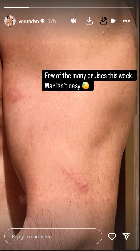 Varun Dhawan says 'war isn't easy' sharing bruised photos of himself 936316
