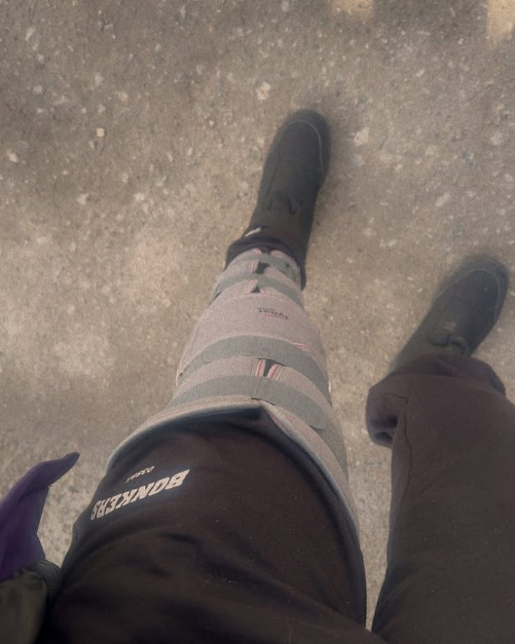 Garima Chaurasia On Two-Month Bed Rest After Knee Injury Says, 