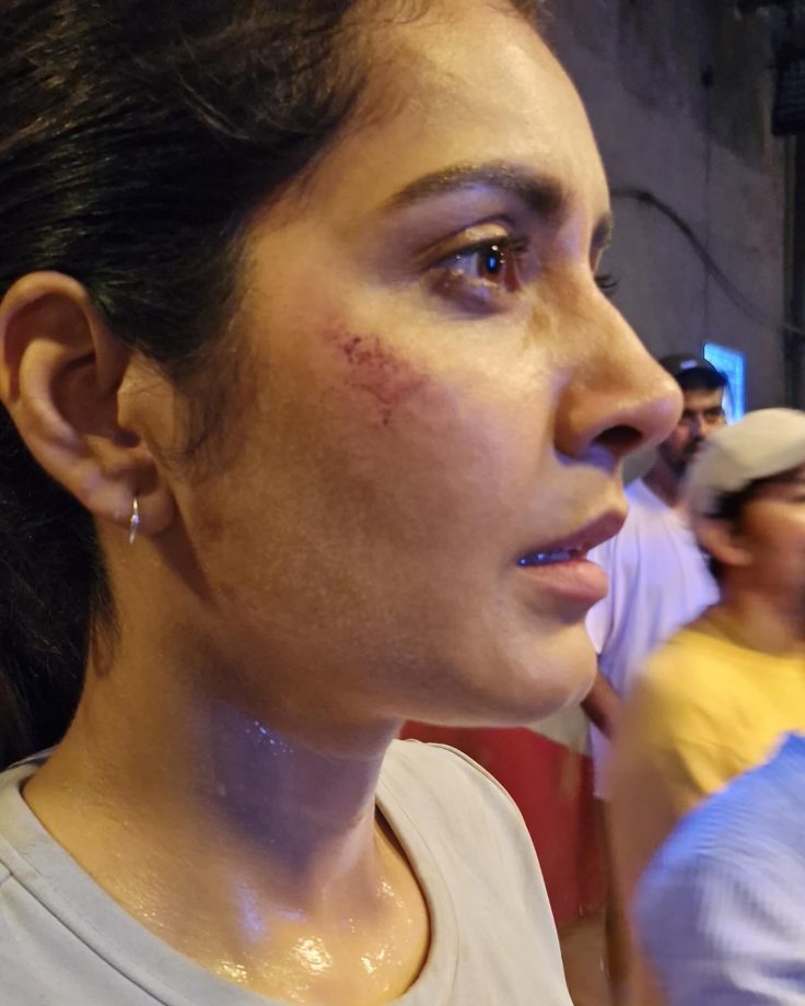 Raashii Khanna Gets Bruises Says, 'Some roles don't ask, they demand your body and bruises' 948533