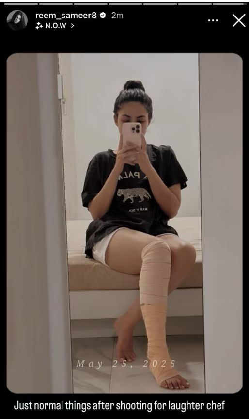 Reem Shaikh Injured At The Sets Of ‘Laughter Chefs 2’; Shares Video For Fans 949317
