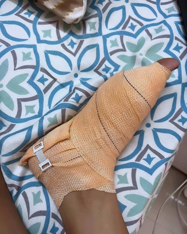 Bigg Boss 15 Fame Donal Bisht Shares Battling Leg Injury From Past 1.5 Years Says, 