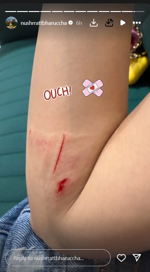 Nushrratt Bharuccha Injured at Friend’s Birthday Bash—Shares Painful Glimpse on Instagram 956614