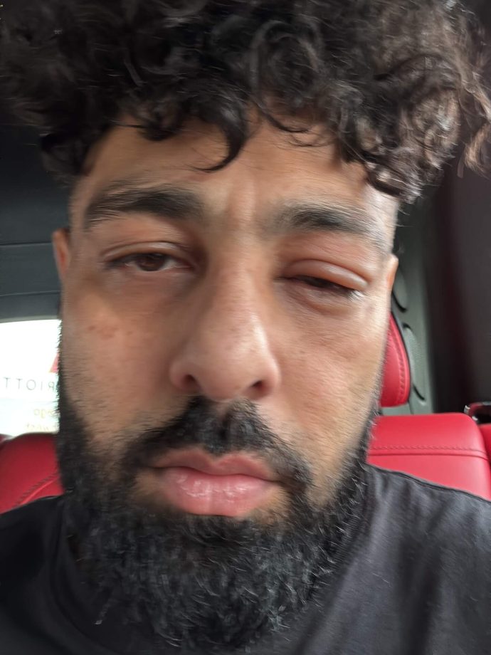 Badshah's Injured Photos Go Viral: Fans Worried After Rapper's Shocking Post 969777
