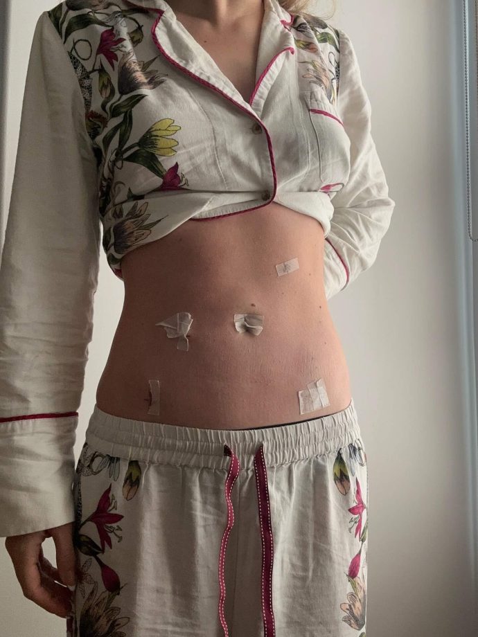 Lili Reinhart Diagnosed With Endometriosis After Being Told There's 'No Cure' For Her Symptoms 979483