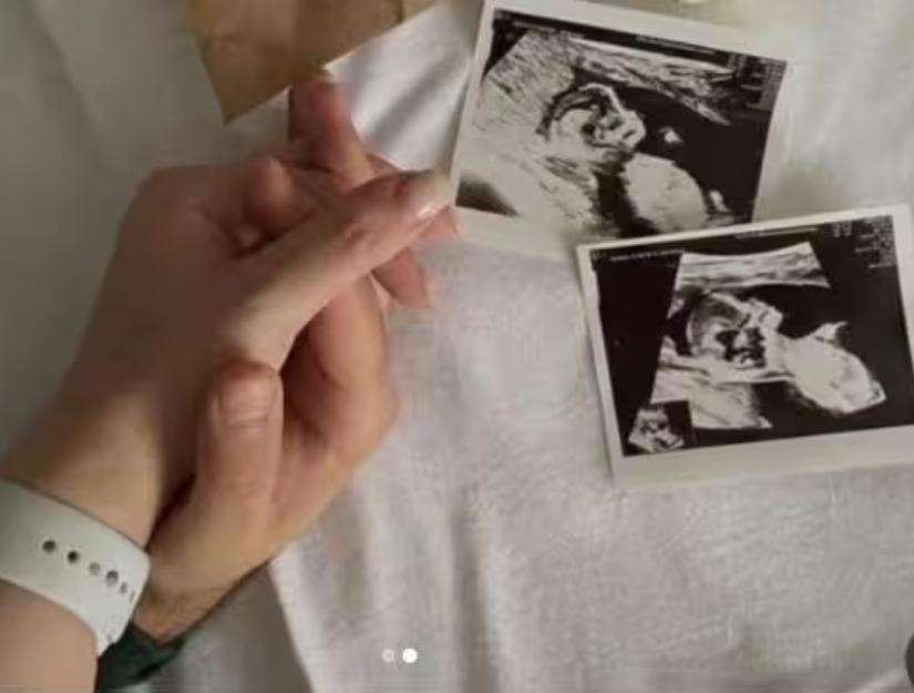 Naagin 3 Actress Surbhi Jyoti To Welcome Twin Babies: Reports 993275