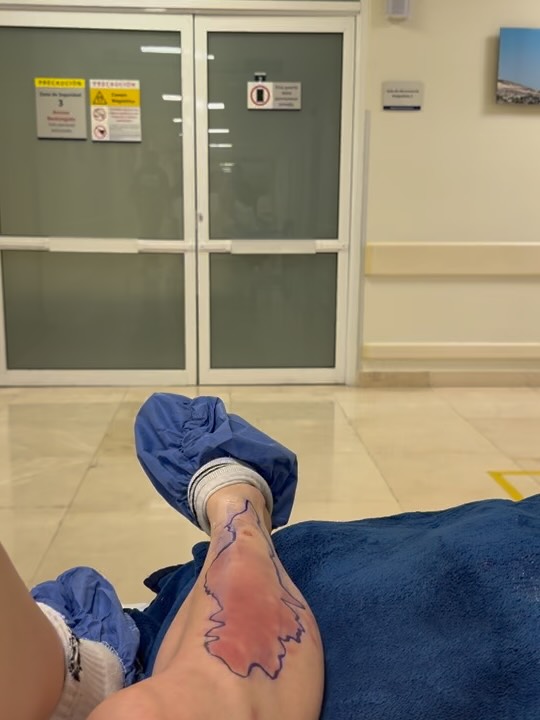 Taylor Momsen Resumes Tour With AC/DC After Scary Poisonous Spider Bite Incident 994516