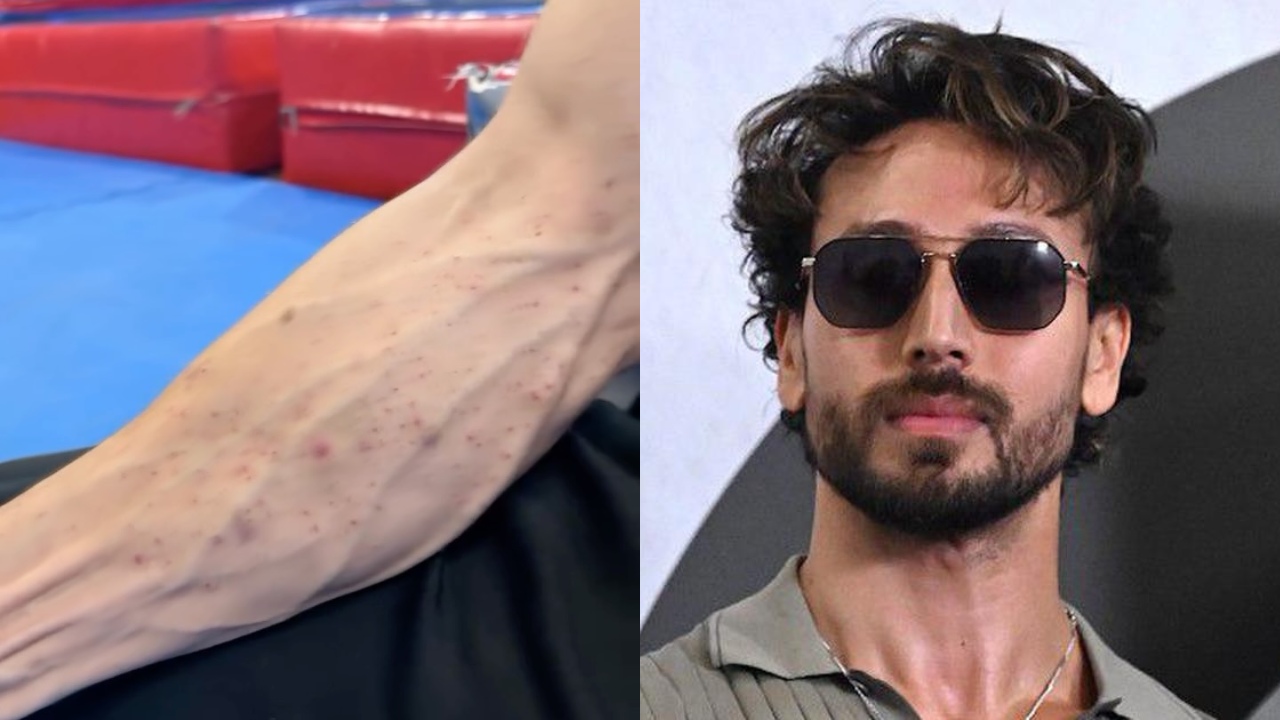 Tiger Shroff Offers A Closer Look At His Injuries After Shocking Firing Incident: Watch 1